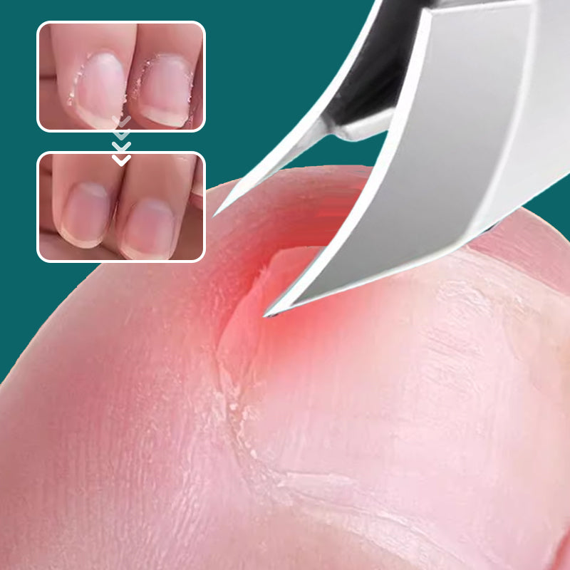 Jogo de 3 Cortadores de Unhas com Borda Inclinada 25° e Design Antirrespingo